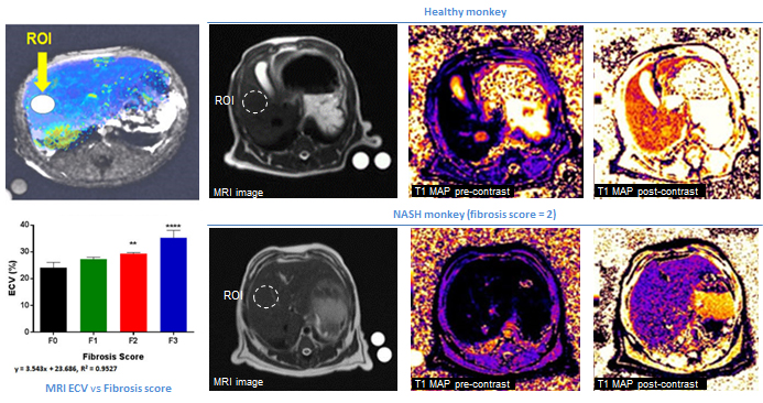 imaging MRI 3.jpg